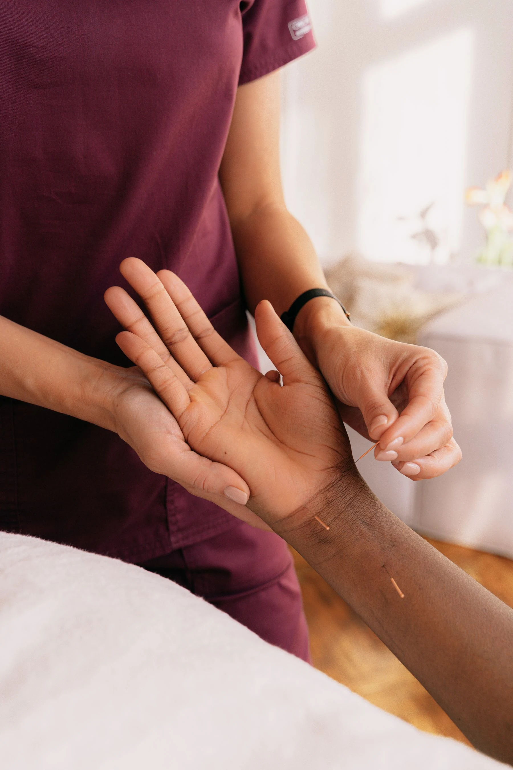 Professional acupuncture treatment
